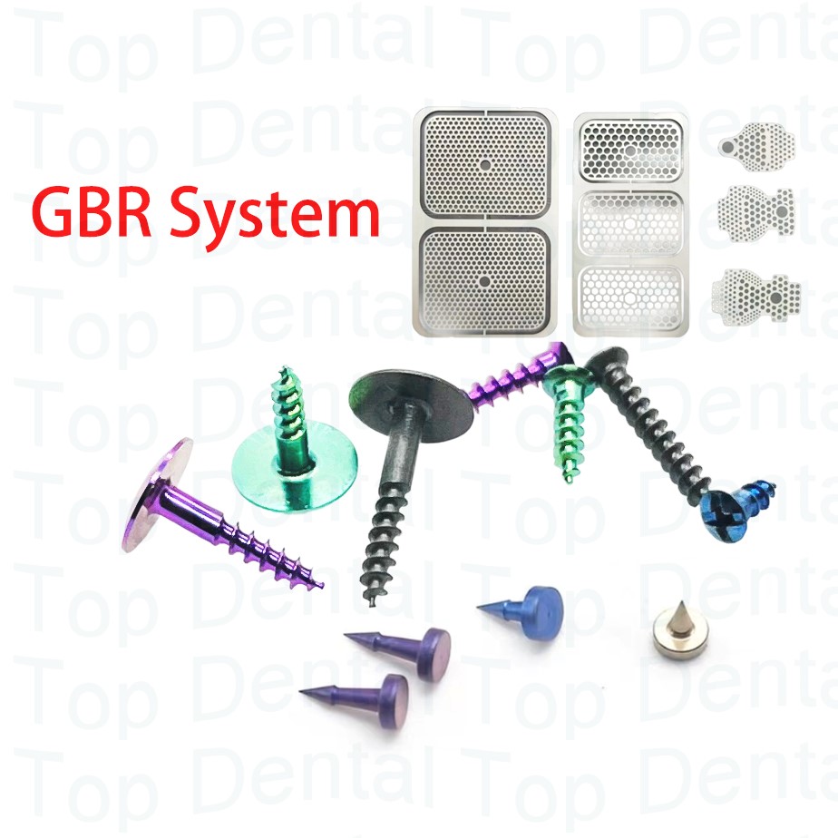 10 шт., стоматологическая сист – обзор и цена Stabilizer Screw In